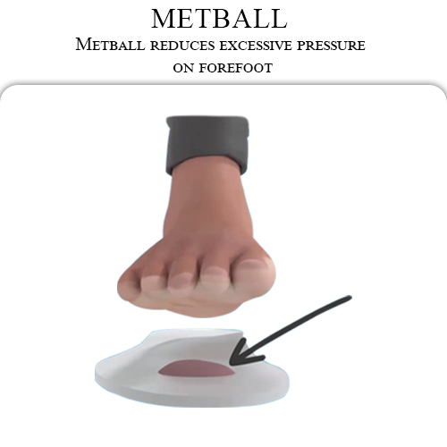 Metball